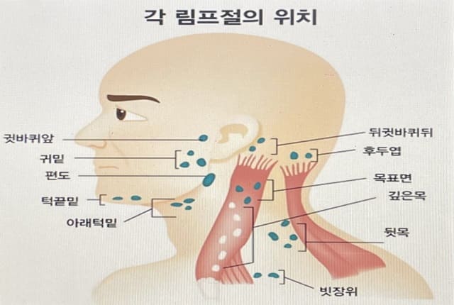림프절의 위치.jpg